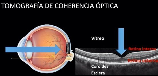 OCT, tecnología láser de última generación